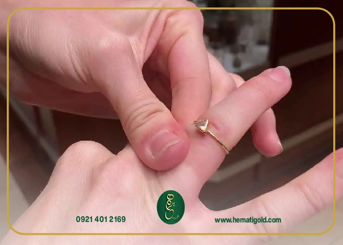 روش‌های درمان حساسیت به طلا