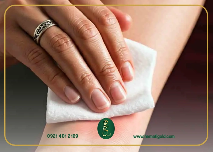 نشانه‌های حساسیت به طلا (علائم واکنش آلرژیک)